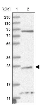 Lane 1: Marker [kDa] 230, 130, 95, 72, 56, 36, 28, 17, 11_br/_Lane 2: Human cell line RT-4