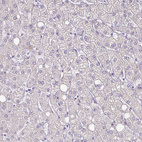 Immunohistochemical staining of human liver shows no positivity in hepatocytes as expected.