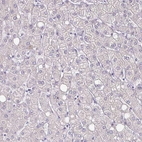 Immunohistochemical staining of human liver shows no positivity in hepatocytes as expected.