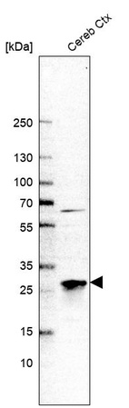 Western blot analysis in human cerebral cortex tissue.