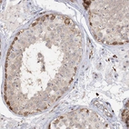 Anti-PIWIL4 Antibody