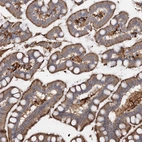 Immunohistochemical staining of human small intestine shows moderate cytoplasmic and membranous positivity in glandular cells.