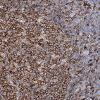 Immunohistochemical staining of human tonsil shows moderate cytoplasmic and membranous positivity in germinal and non germinal center cells.