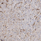 Immunohistochemical staining of human liver shows no positivity in hepatocytes as expected.