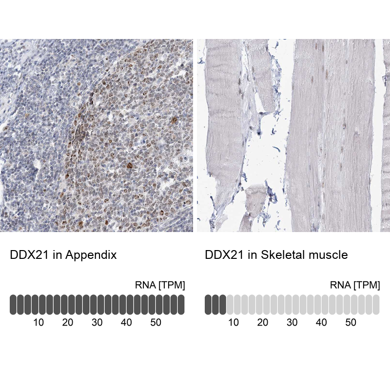 Anti-DDX21 Antibody