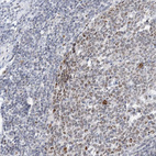 Immunohistochemical staining of human appendix shows strong positivity in nucleoli in lymphoid tissue.
