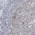 Immunohistochemical staining of human appendix shows strong positivity in nucleoli in lymphoid tissue.