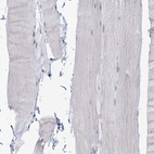 Immunohistochemical staining of human skeletal muscle shows no positivity in nucleoli in myocytes as expected.