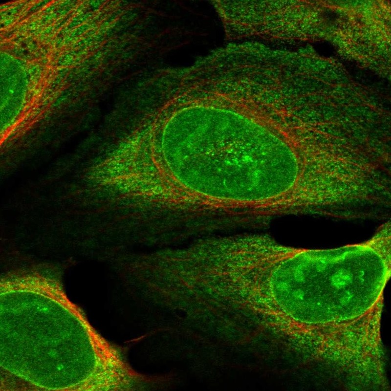 Anti-ZNF474 Antibody