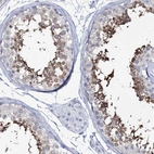 Immunohistochemical staining of human testis shows high expression.