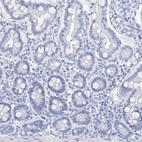 Immunohistochemical staining of human duodenum shows low expression as expected.
