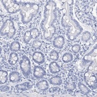 Anti-DPCD Antibody