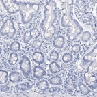 Immunohistochemical staining of human duodenum shows low expression as expected.