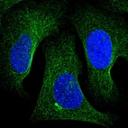 Anti-TNKS2 Antibody