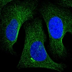 Anti-TNKS2 Antibody
