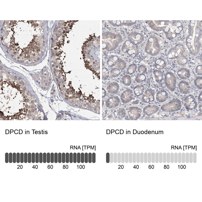 Anti-DPCD Antibody