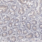 Immunohistochemical staining of human duodenum shows low expression as expected.