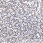 Immunohistochemical staining of human duodenum shows low expression as expected.