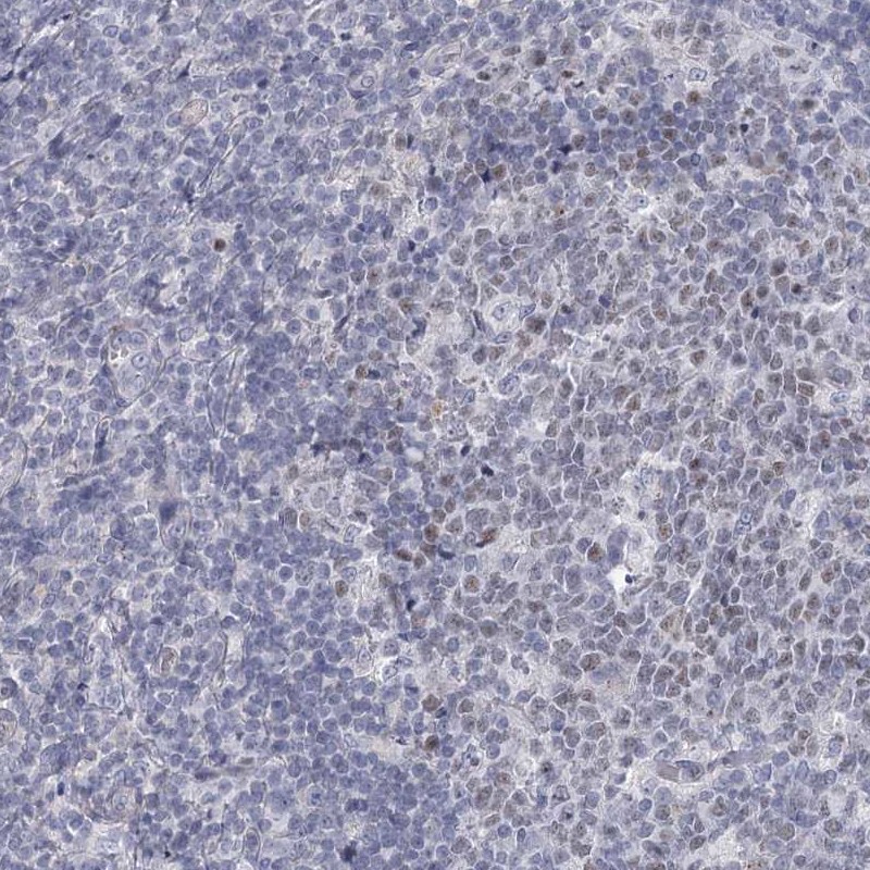 Anti-FAM76B Antibody