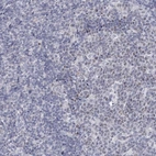 Anti-FAM76B Antibody
