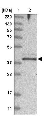 Lane 1: Marker [kDa] 230, 130, 95, 72, 56, 36, 28, 17, 11_br/_Lane 2: Human cell line RT-4