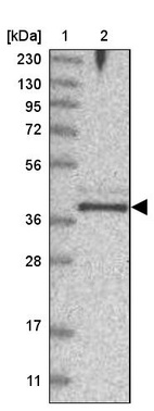 Anti-FAM76B Antibody