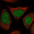 Immunofluorescent staining of human cell line U-2 OS shows localization to nucleus, nucleoli fibrillar center & nuclear membrane.