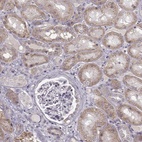 Anti-SLC4A5 Antibody