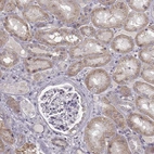 Anti-SLC4A5 Antibody