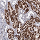 Immunohistochemical staining of human kidney shows high expression.