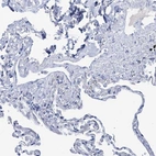 Immunohistochemical staining of human lung shows low expression as expected.