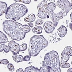 Immunohistochemical staining of human placenta shows moderate positivity in endothelial cells.