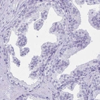 Immunohistochemical staining of human prostate shows no positivity in glandular cells as expected.