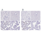 Immunohistochemical staining of human kidney, liver, placenta and prostate using Anti-LIN28B antibody HPA036630 (A) shows similar protein distribution across tissues to independent antibody HPA061745 (B).