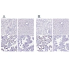 Immunohistochemical staining of human kidney, liver, placenta and prostate using Anti-LIN28B antibody HPA036630 (A) shows similar protein distribution across tissues to independent antibody HPA061745 (B).