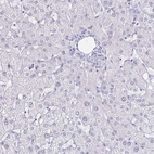 Immunohistochemical staining of human liver shows no positivity in hepatocytes as expected.