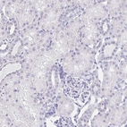Immunohistochemical staining of human kidney shows no positivity in cells in tubules as expected.
