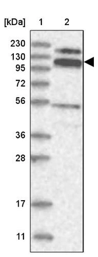 Lane 1: Marker [kDa] 230, 130, 95, 72, 56, 36, 28, 17, 11_br/_Lane 2: Human cell line RT-4