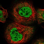 Immunofluorescent staining of human cell line A-431 shows localization to nucleoplasm.