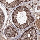 Immunohistochemical staining of human testis shows strong granular cytoplasmic positivity in cells in seminiferous ducts.