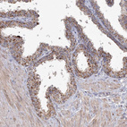 Immunohistochemical staining of human prostate shows moderate granular cytoplasmic positivity in glandular cells.
