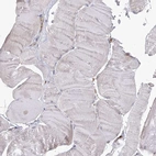 Immunohistochemical staining of human skeletal muscle shows no positivity in myocytes as expected.