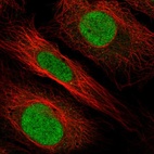 Anti-HOXB1 Antibody