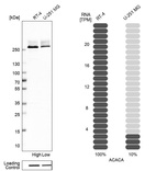 Anti-ACACA Antibody