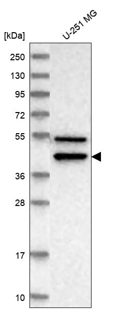 Anti-IL11RA Antibody