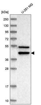 Anti-IL11RA Antibody