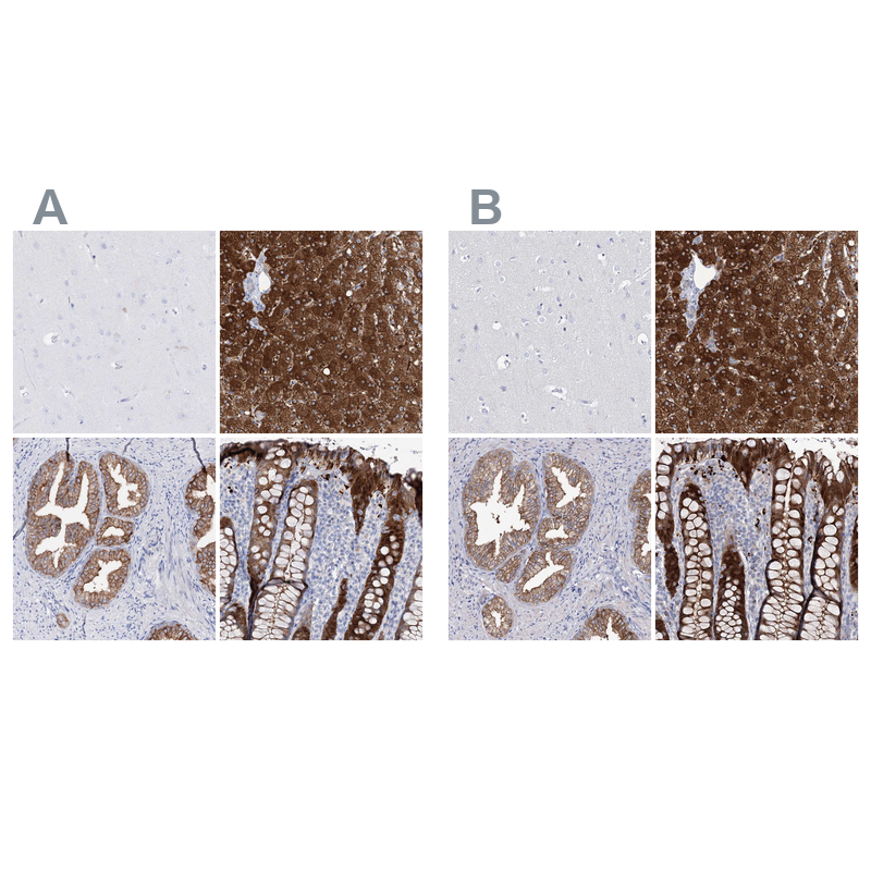 Anti-UGDH Antibody