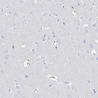 Immunohistochemical staining of human cerebral cortex shows no positivity in neurons as expected.