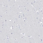 Immunohistochemical staining of human cerebral cortex shows no positivity in neurons as expected.