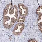 Immunohistochemical staining of human prostate shows moderate cytoplasmic positivity in glandular cells.